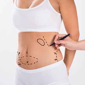 Body Procedures
